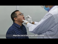 اختبار المسحة